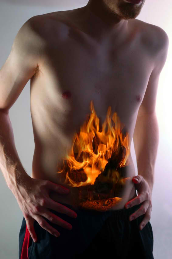Irritable Bowel Syndrome