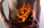 Irritable Bowel Syndrome